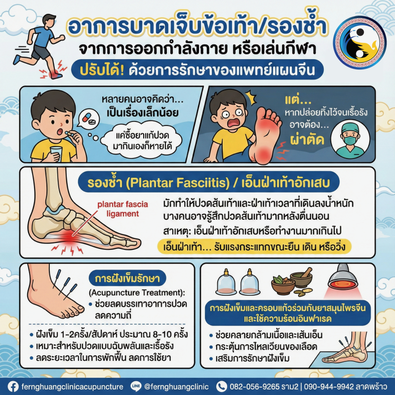 ฝังเข็ม ครอบแก้ว รองช้ำ เล่นกีฬา บาดเจ็บ