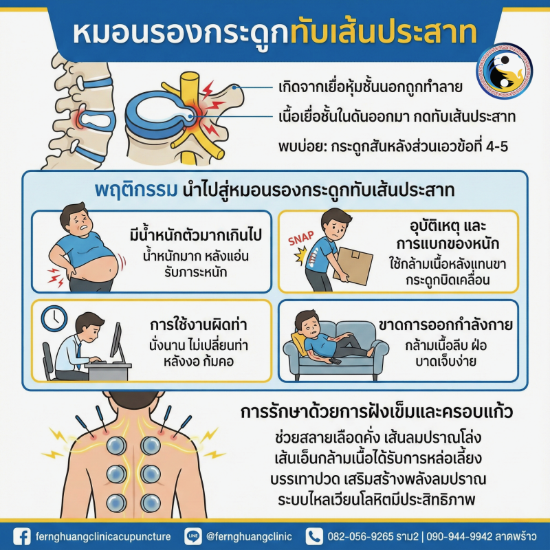 ฝังเข็ม หมอนรองกระดูก