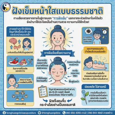 ฝังเข็มหน้าใส สิว