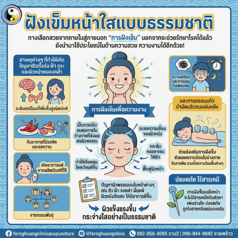 ฝังเข็มหน้าใส สิว