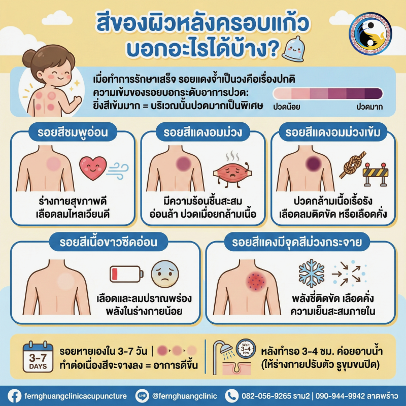 สีครอบแก้ว บอกอะไรได้บ้าง